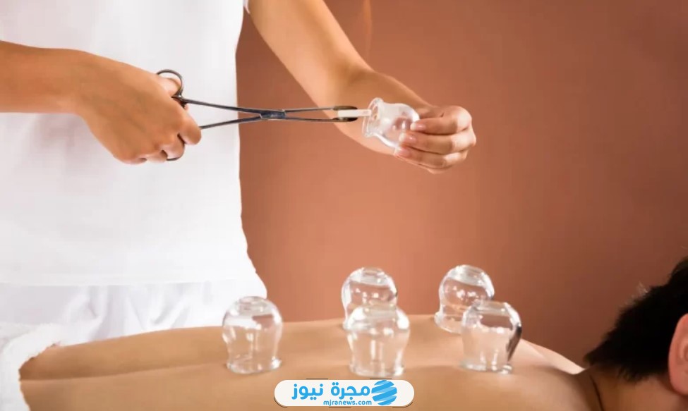 أفضل أيام الحجامة في شهر أبريل نيسان