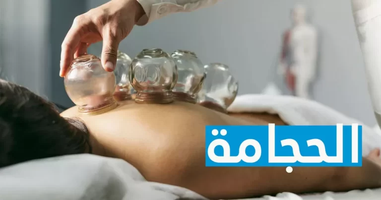 أفضل أيام الحجامة لشهر أغسطس