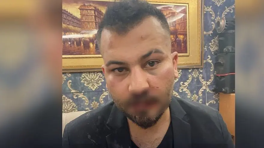 الاعتداء بالحذاء على الفنان بسمان الخطيب