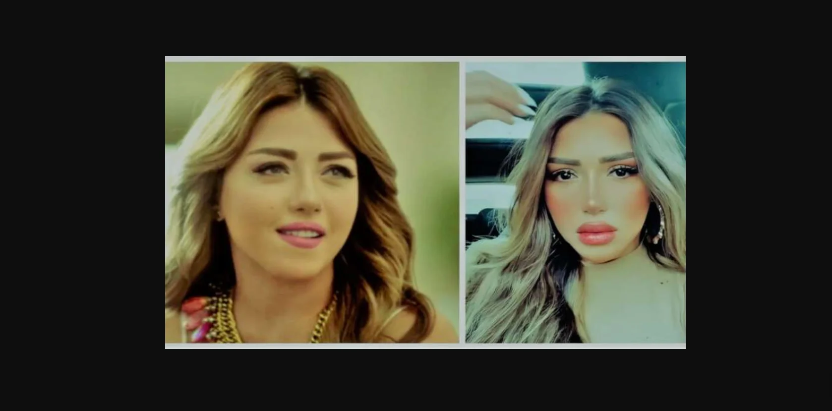 صور سارة سلامة بعد عملية التجميل