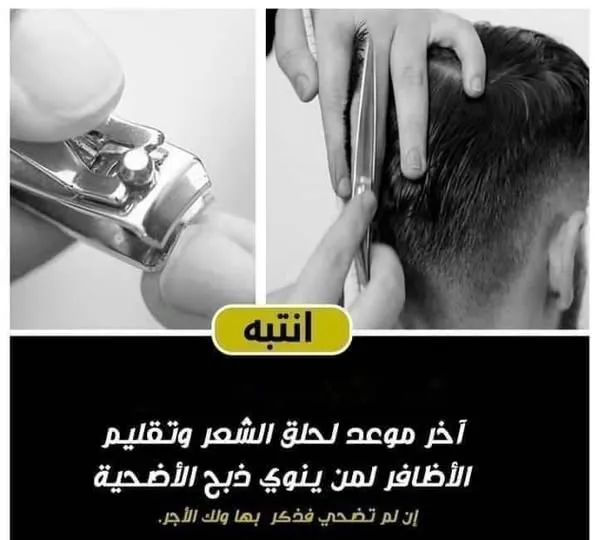 متى آخر وقت لقص الأظافر للمضحي