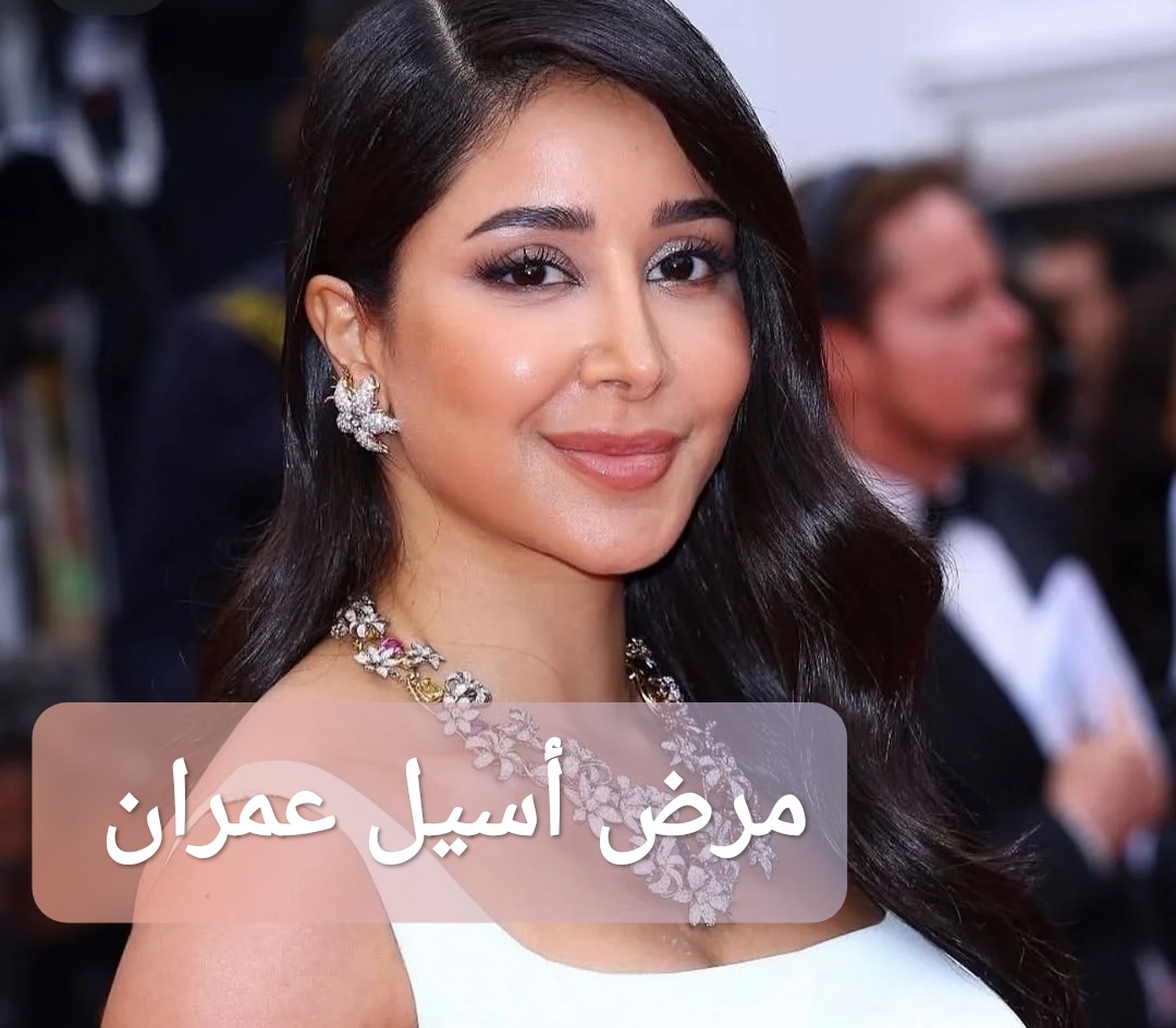 مرض أسيل عمران