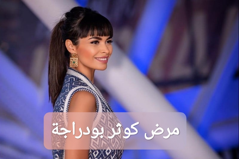 مرض كوثر بودراجة