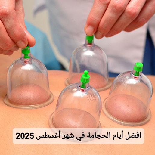 افضل أيام الحجامة في شهر أغسطس 2025