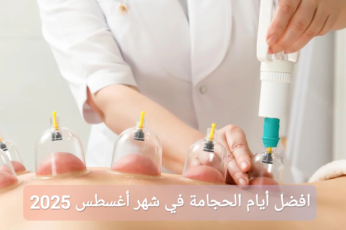 افضل أيام الحجامة في شهر أغسطس 2025