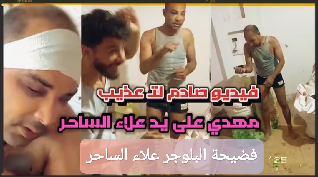 فضيحة البلوجر علاء الساحر