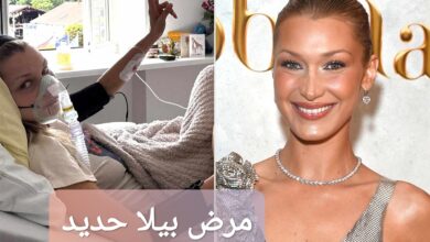 مرض بيلا حديد