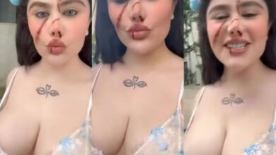 صور انجي خوري المشوهة